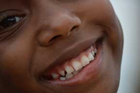 Close up of young boy's smile