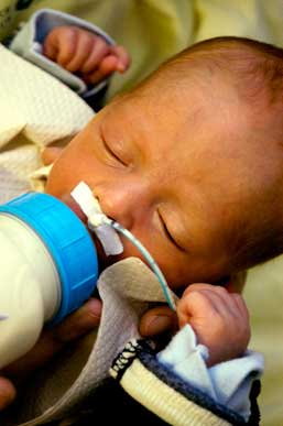 Premature Infant with Jaundice Drinking Formula from a Bottle